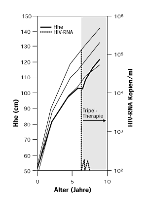Wachstumskurve eines HIV-infizierten M&auml;dchens
