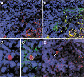 Lymphatisches Gewebe